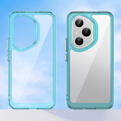 Honor 400 Pro Soft Gel Case [Clear Blue]